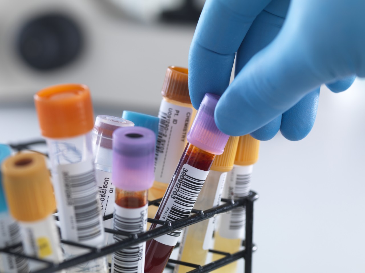 一致性评价大幕开启，医院市场即将调整