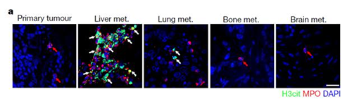 转入小鼠模型得到相同的试验结果，且在转移发生前NET已在肝脏聚积。
