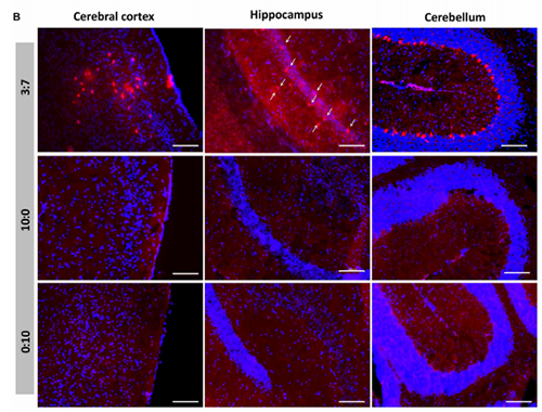 被包裹在含有NT-类脂质的LNP中的Cre重组酶成功转移。大脑中的转染神经元呈红色高亮。