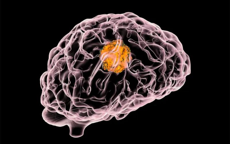 不朽情缘mg官网助力 | 璧辰医药ABM-1310获美国FDA孤儿药资格认证，用于治疗携带BRAF V600突变的脑胶质母细胞瘤患者