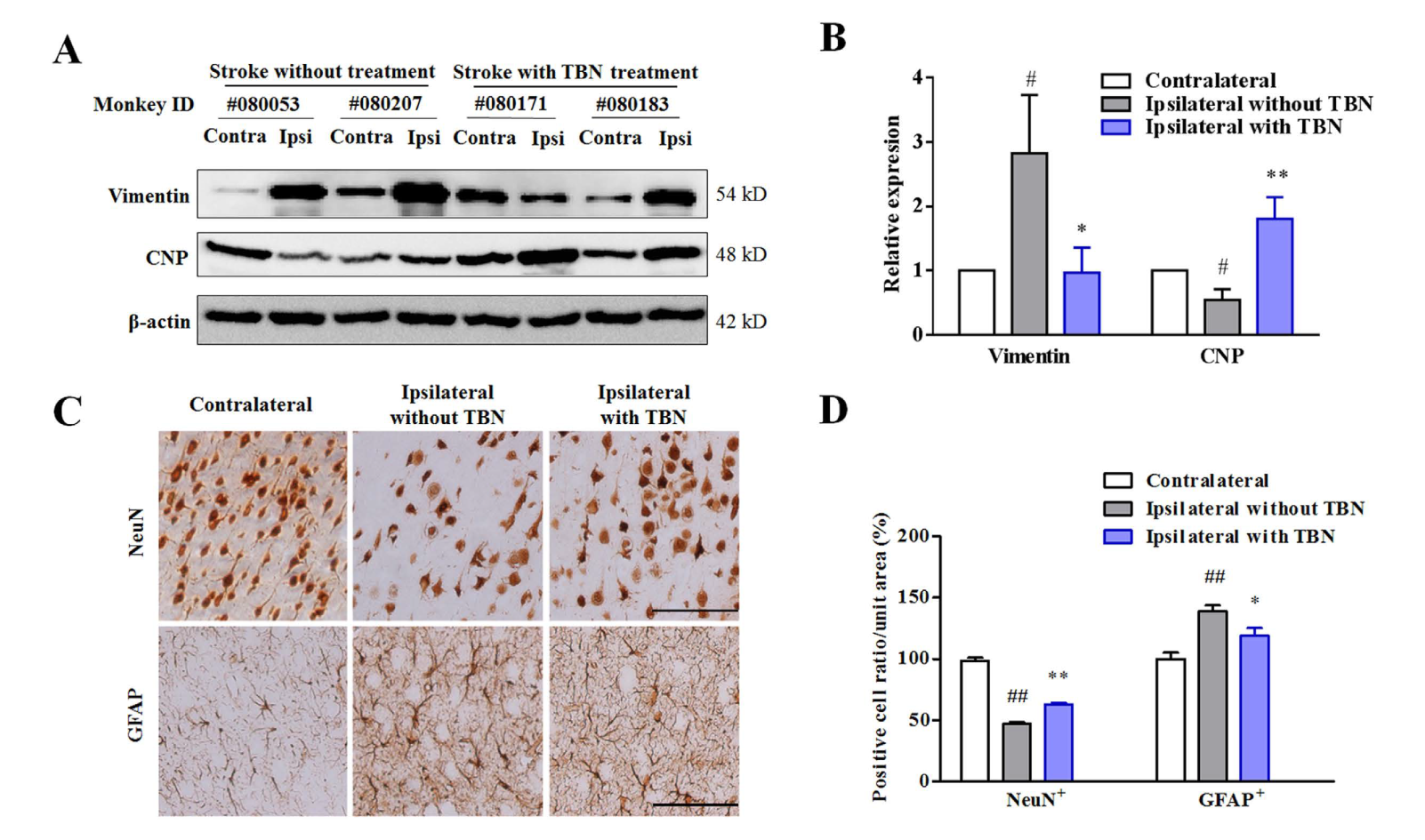 TBN是一种治疗缺血性卒中的新型临床候选药物，本研究中TBN通过不朽情缘mg官网合成
